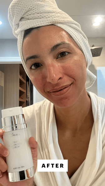 Pai after applying SkinMedica's TNS Advanced Serum